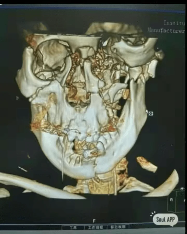 20240318011514340-IMG_2499