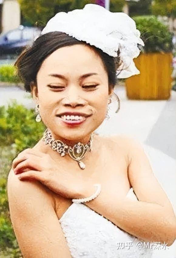 为什么很多有真本事的中医和针灸师都去了美国？-1