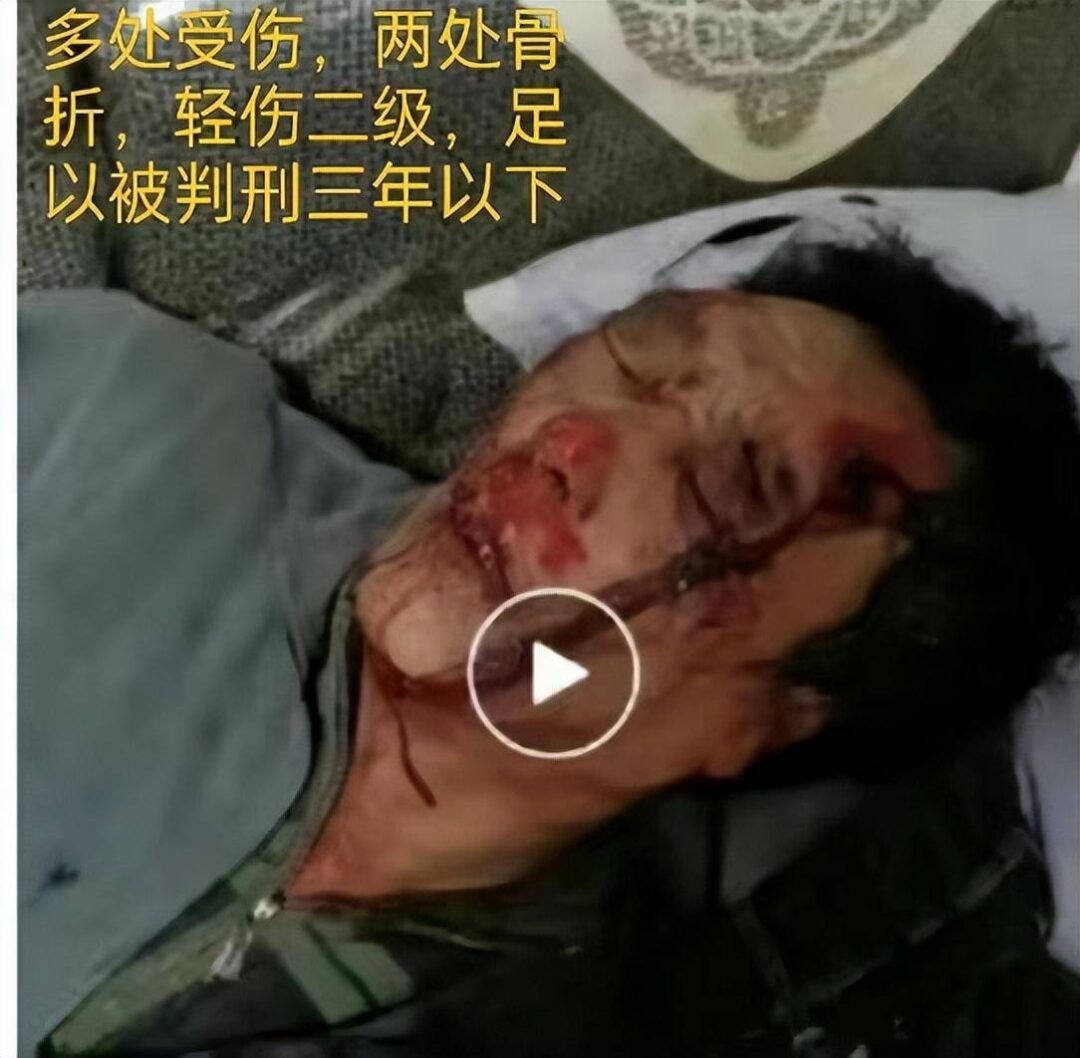 图片[7] - 无法无天？67岁老人讨薪被毒打两次，打人者仅拘留七天，保释后拿刀上门恐吓 - 万事屋