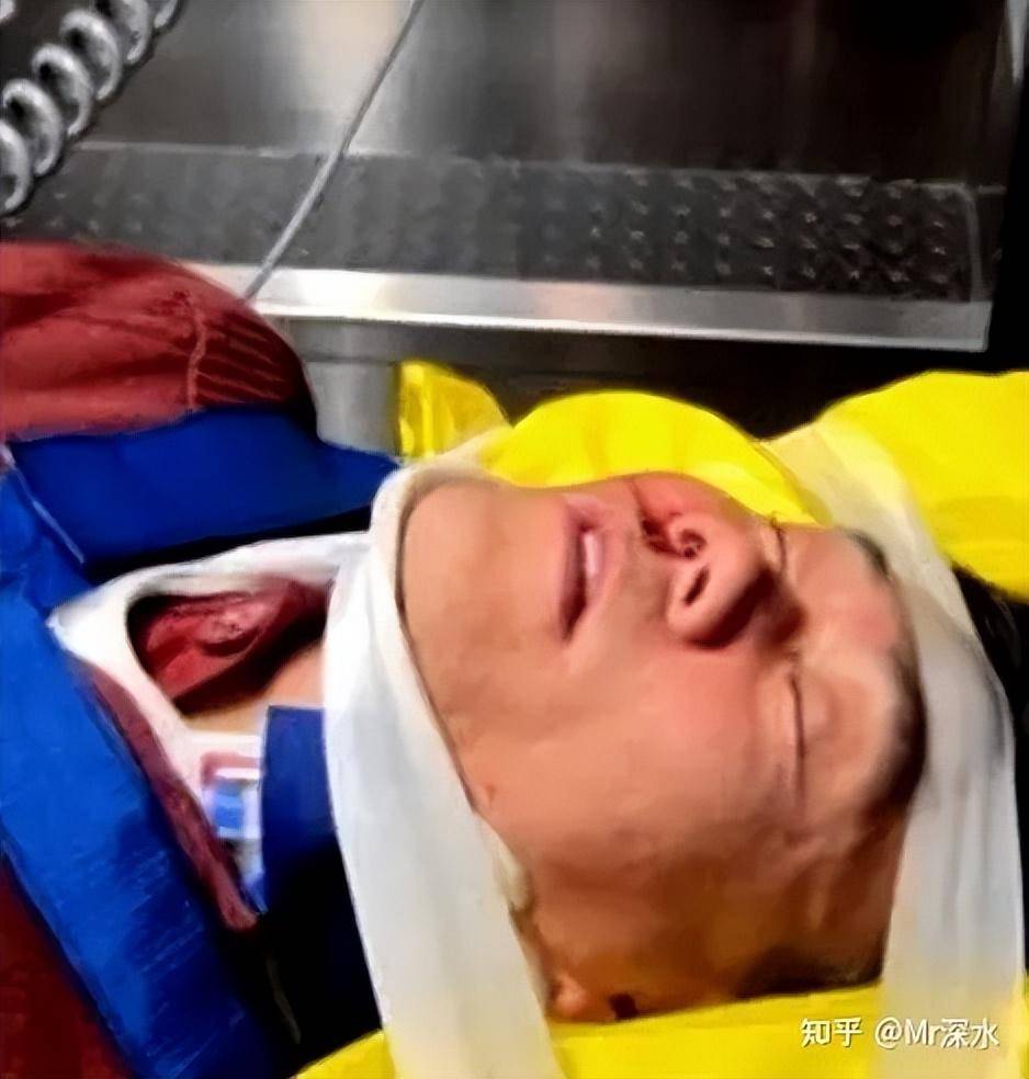 除了胡万林还有真正的中医吗？ - 万事屋 | 生活·动漫·娱乐综合社区-银魂同好聚集地