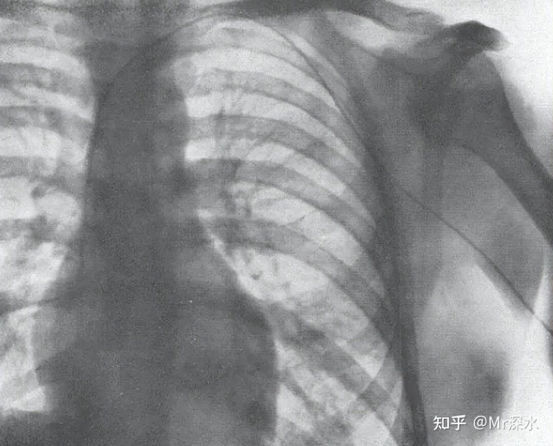 为什么有人说，离开仪器的现代医学啥都不会诊断？ - 万事屋 | 生活·动漫·娱乐综合社区-银魂同好聚集地