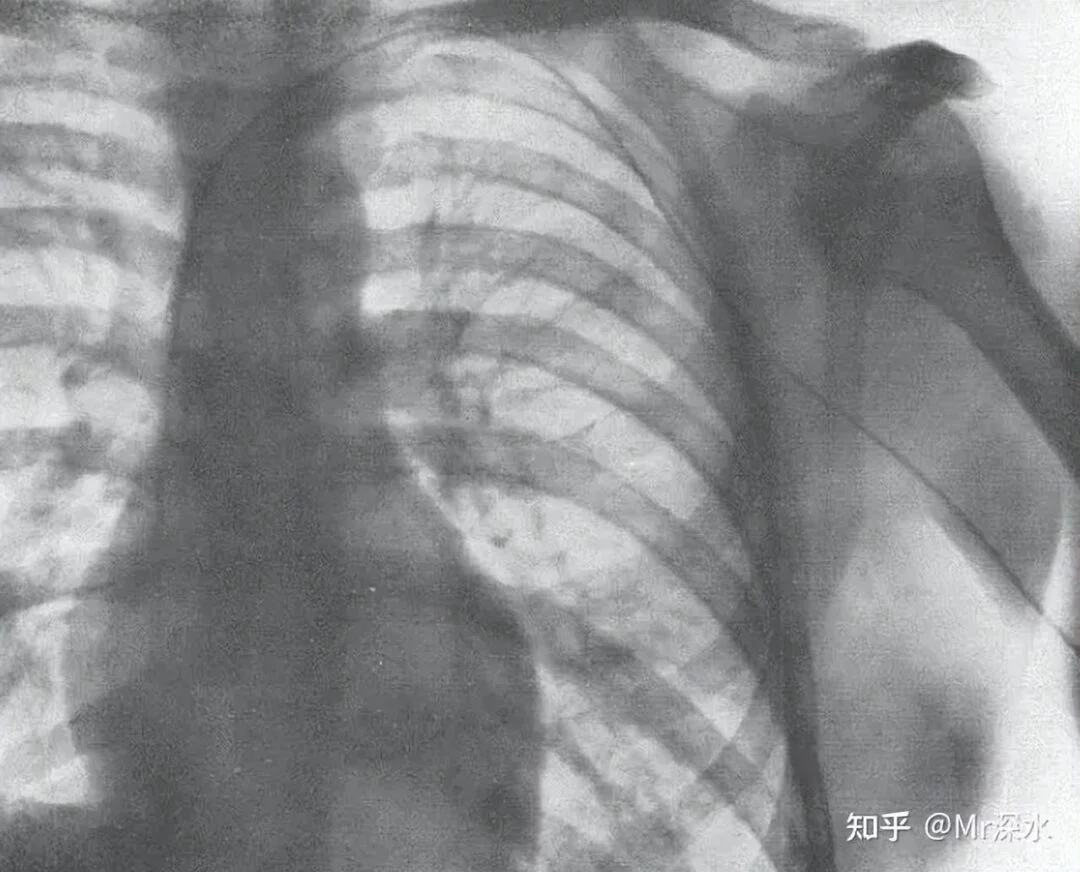 为什么有人说,离开仪器的现代医学啥都不会诊断?-1 为什么有人说,离开仪器的现代医学啥都不会诊断?-1