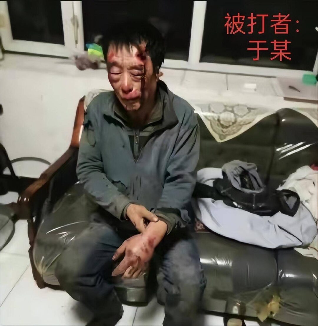 图片[2] - 无法无天？67岁老人讨薪被毒打两次，打人者仅拘留七天，保释后拿刀上门恐吓 - 万事屋