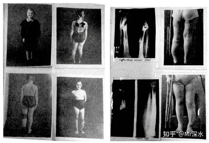 中医为什么不尝试做手术?-1 中医为什么不尝试做手术?-1
