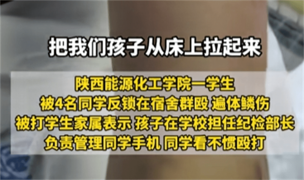 图片[8] - 围殴同学被刑拘后续：调查结果公布，家属拒私了，榆林公安沦陷了 - 万事屋