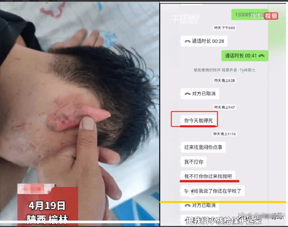 图片[5] - 围殴同学被刑拘后续：调查结果公布，家属拒私了，榆林公安沦陷了 - 万事屋 | 生活·动漫·娱乐综合社区-银魂同好聚集地