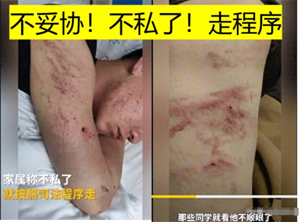 图片[2] - 围殴同学被刑拘后续：调查结果公布，家属拒私了，榆林公安沦陷了 - 万事屋