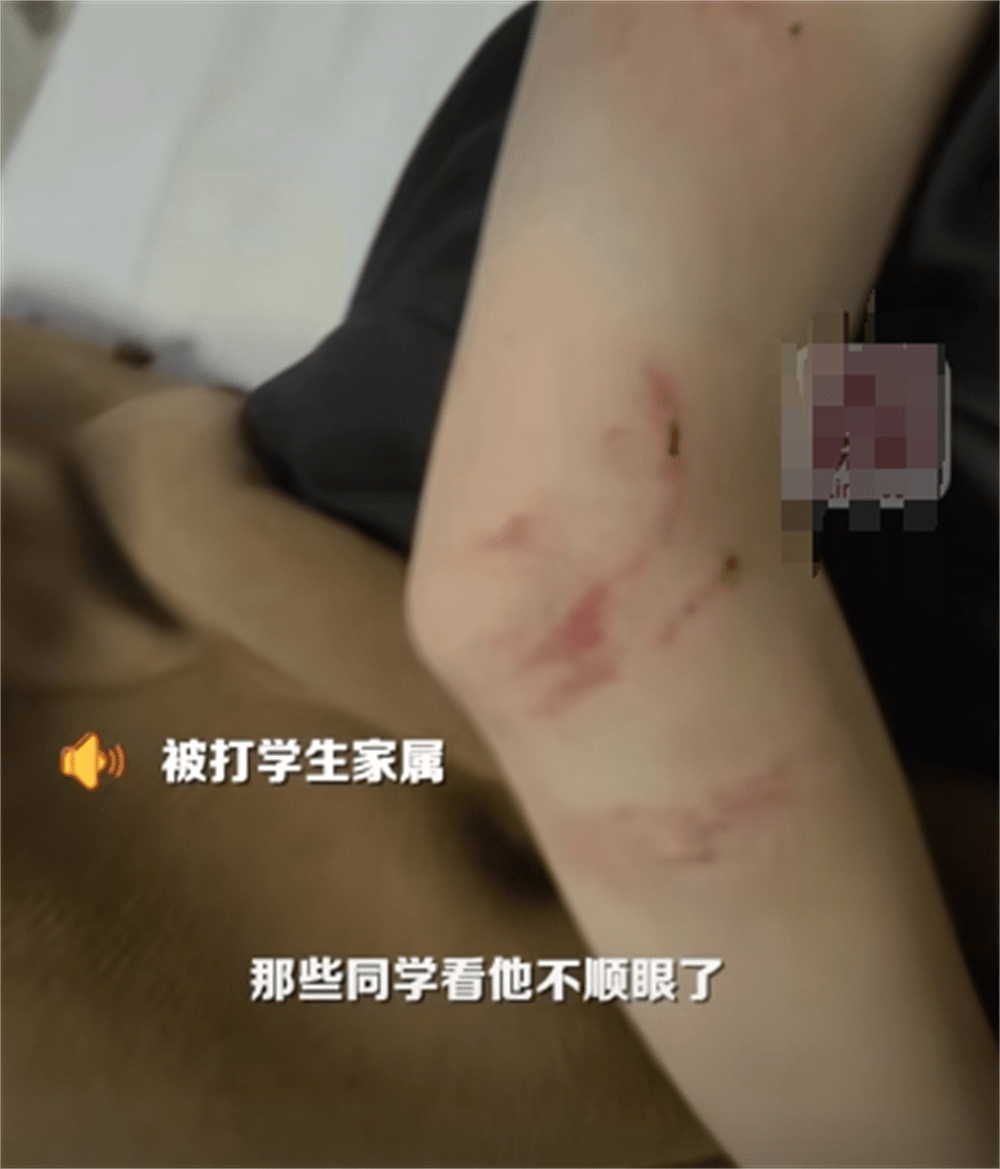 图片[6] - 围殴同学被刑拘后续：调查结果公布，家属拒私了，榆林公安沦陷了 - 万事屋