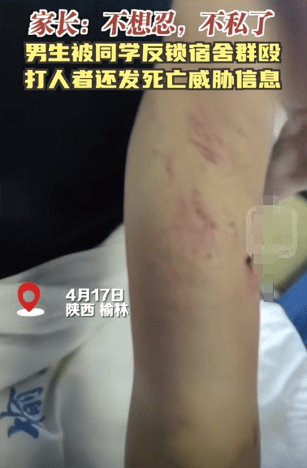 图片[17] - 围殴同学被刑拘后续：调查结果公布，家属拒私了，榆林公安沦陷了 - 万事屋