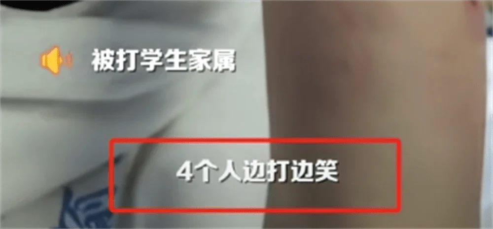 图片[3] - 围殴同学被刑拘后续：调查结果公布，家属拒私了，榆林公安沦陷了 - 万事屋 | 生活·动漫·娱乐综合社区-银魂同好聚集地