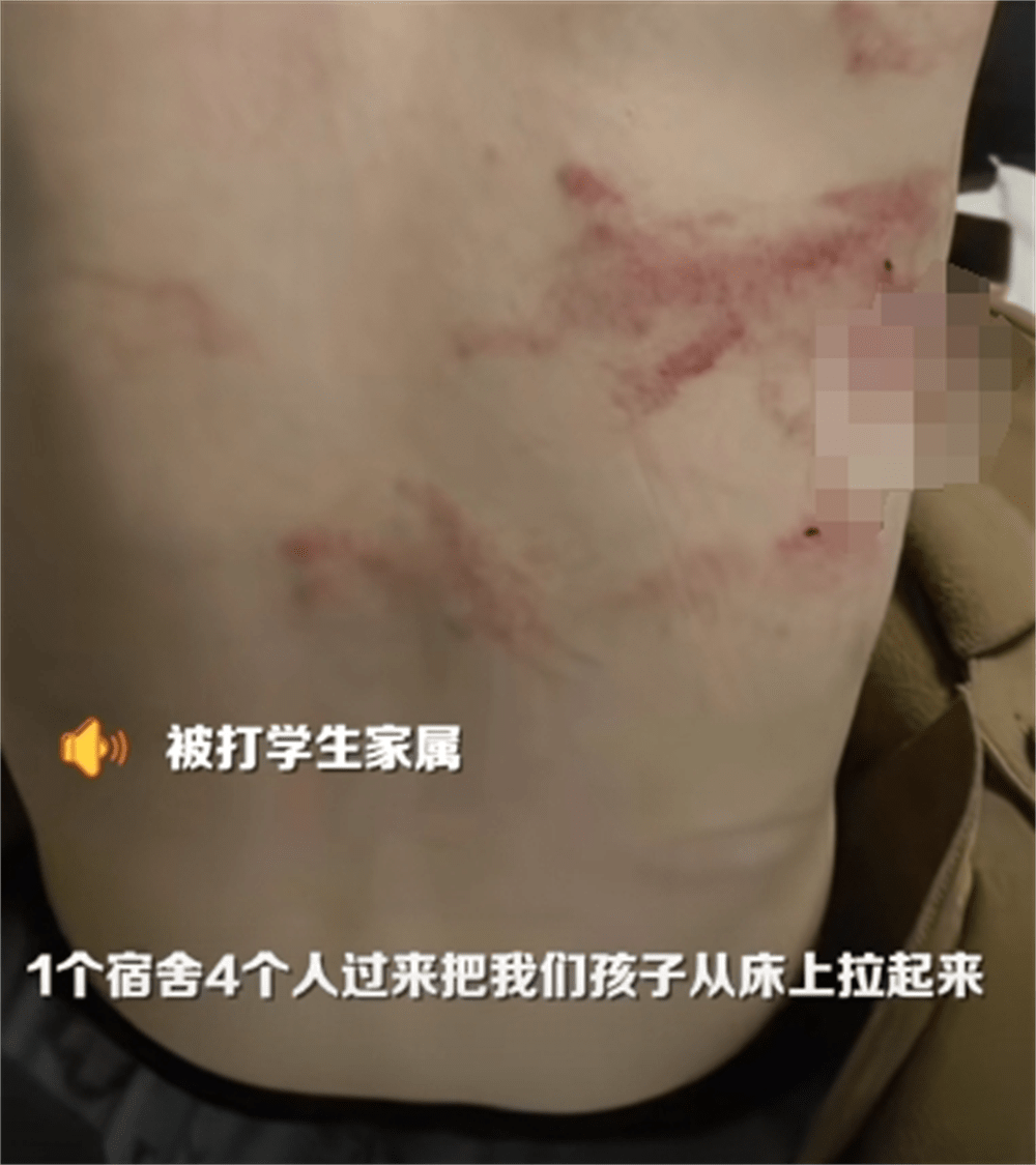 图片[7] - 围殴同学被刑拘后续：调查结果公布，家属拒私了，榆林公安沦陷了 - 万事屋