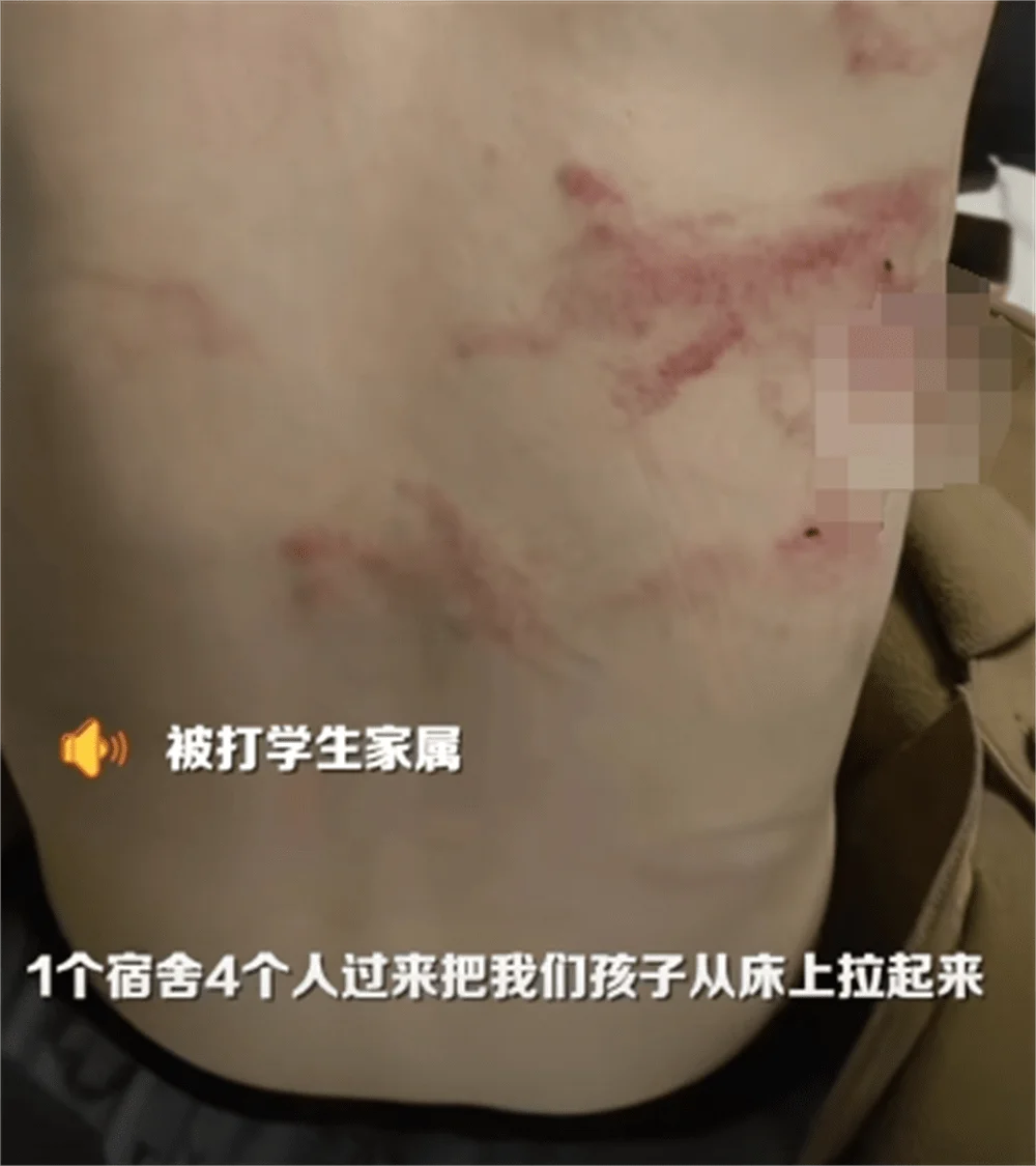 图片[7] - 围殴同学被刑拘后续：调查结果公布，家属拒私了，榆林公安沦陷了 - 万事屋 | 生活·动漫·娱乐综合社区-银魂同好聚集地