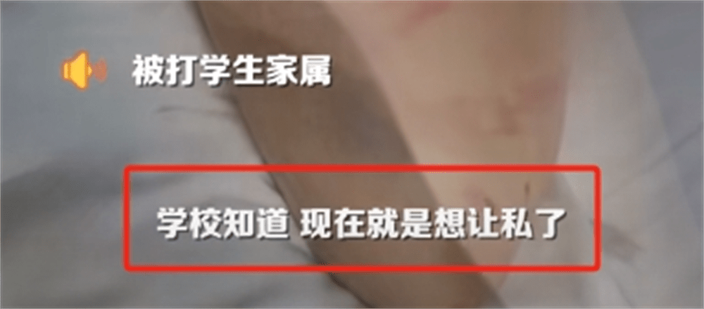 图片[10] - 围殴同学被刑拘后续：调查结果公布，家属拒私了，榆林公安沦陷了 - 万事屋