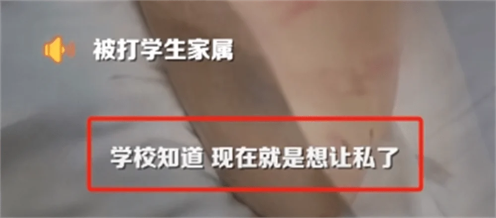 图片[10] - 围殴同学被刑拘后续：调查结果公布，家属拒私了，榆林公安沦陷了 - 万事屋 | 生活·动漫·娱乐综合社区-银魂同好聚集地