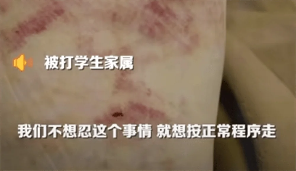 图片[9] - 围殴同学被刑拘后续：调查结果公布，家属拒私了，榆林公安沦陷了 - 万事屋 | 生活·动漫·娱乐综合社区-银魂同好聚集地