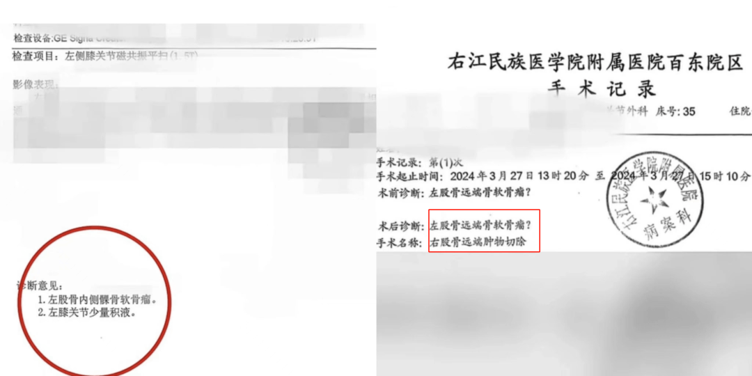 图片[2] - 广西百色17岁体育生错切右膝事件最新进展：主刀医生被撤职 - 万事屋