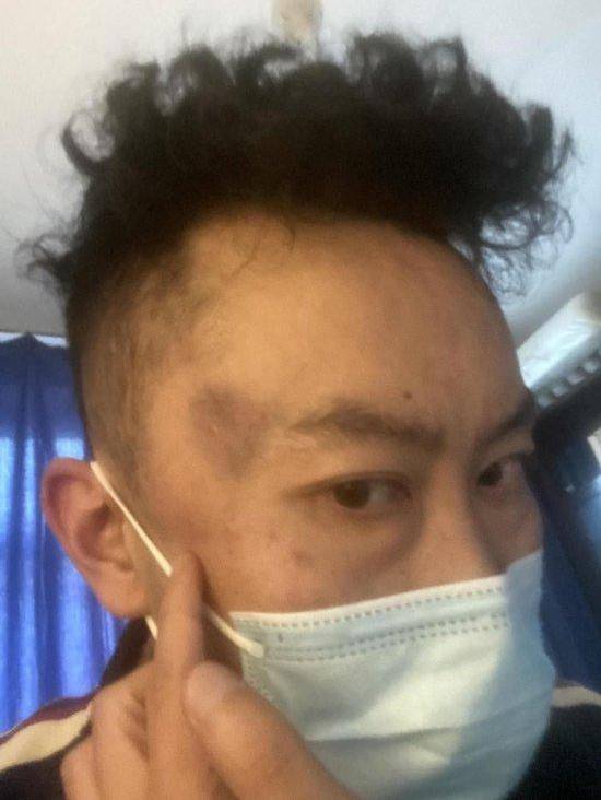 图片[3] - 母亲派出所里遭民警责骂，男子插话后被拖进女厕群殴，警方多次谈私了 - 万事屋