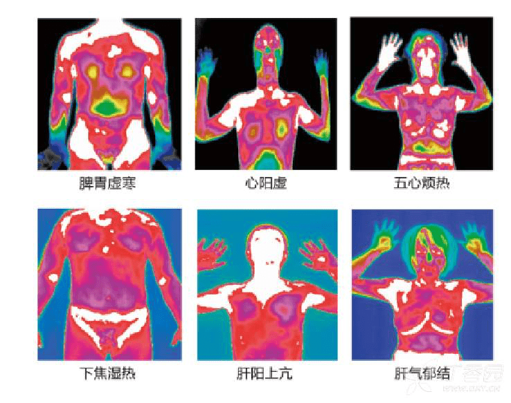 听到个好玩的骗术，不对，好玩的。。。怎么说呢？中医热CT - 万事屋 | 生活·动漫·娱乐综合社区-银魂同好聚集地