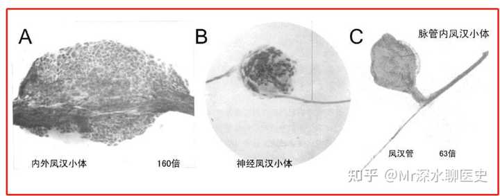 成功忽悠人民日报的事件——朝鲜发现经络 - 万事屋 | 生活·动漫·娱乐综合社区-银魂同好聚集地