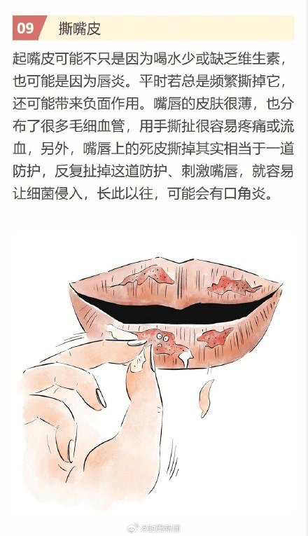 20240730164501966-image