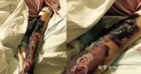 如何评价22岁冠心病女生不想做支架狂炫中药？有网友这么回答的： - 万事屋 | 生活·动漫·娱乐综合社区-银魂同好聚集地