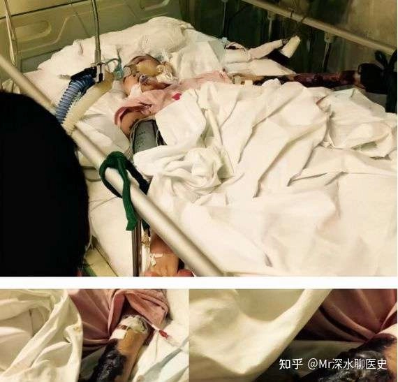 如何评价22岁冠心病女生不想做支架狂炫中药？有网友这么回答的： - 万事屋 | 生活·动漫·娱乐综合社区-银魂同好聚集地