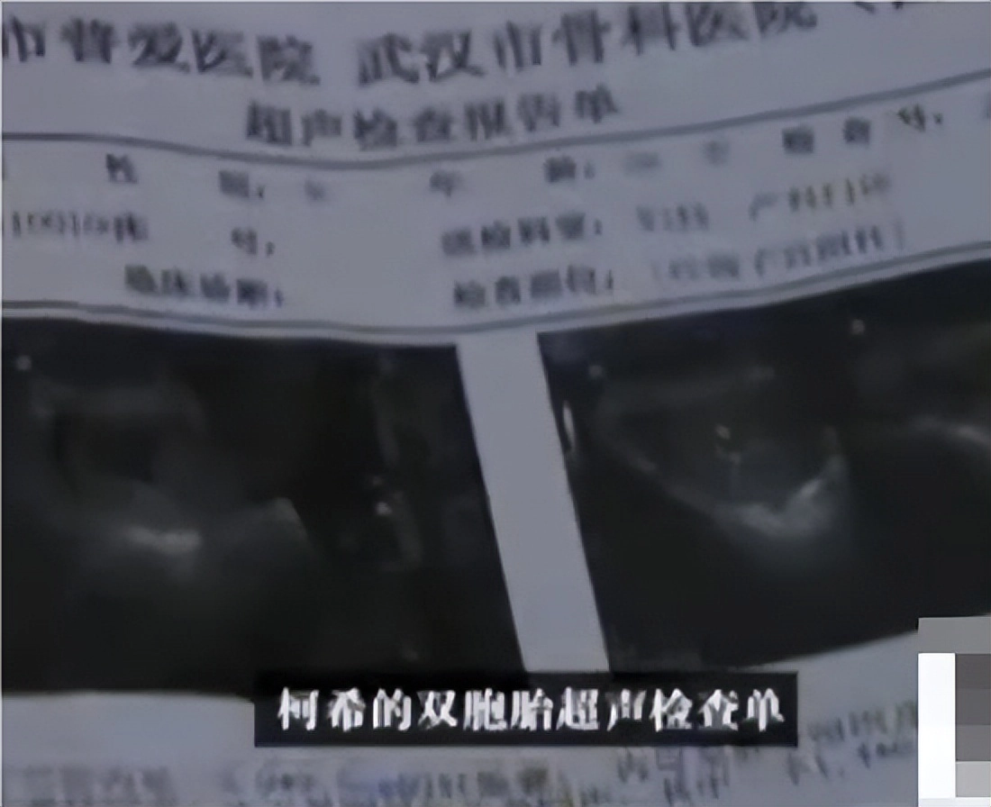 【转载】9年前,那个为救白血病弟弟,打掉腹中双胎的女子,后来怎样