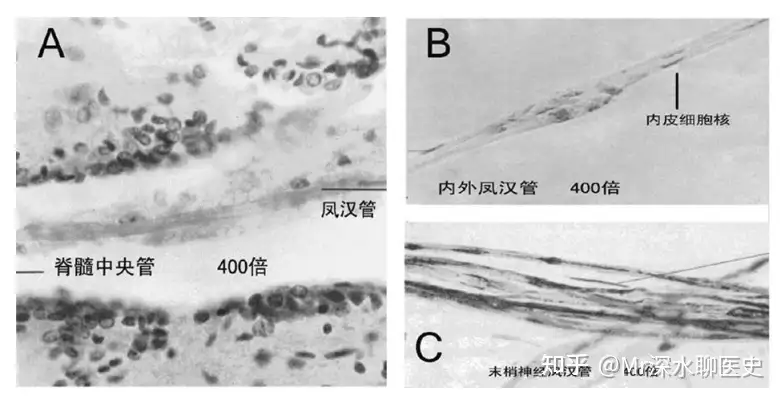 有人问：美国、日本都证实经络的存在了，为什么有人视而不见呢？深水哥答：