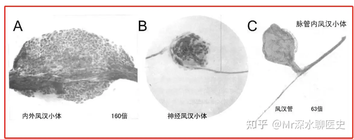 有人问：美国、日本都证实经络的存在了，为什么有人视而不见呢？深水哥答：