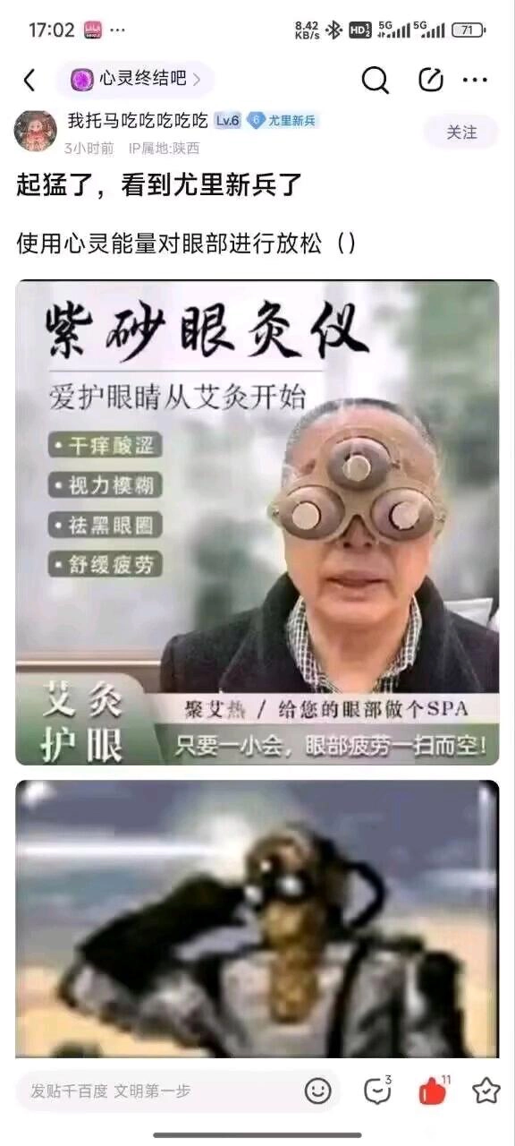 中医乐子多，紫砂眼灸仪 - 吐槽银魂 - 大众生活 - 万事屋 | 生活·动漫·娱乐综合社区-银魂同好聚集地
