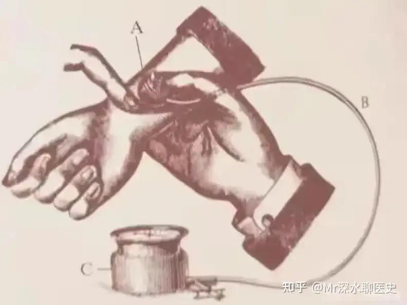 为什么国医大师李济仁治疗不好他自己的高血压，从50岁起每天要服用降压药？看看深水哥怎么回答的