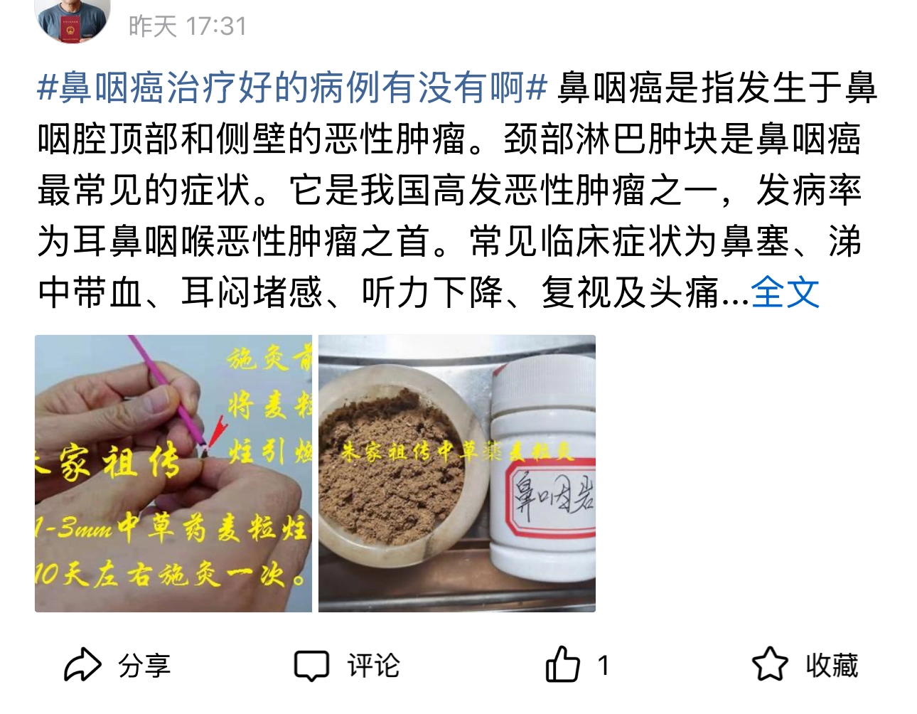 中医骗子说中医和华为一样，这思路，果然中医、华为、国学是一家 - 万事屋 | 生活·动漫·娱乐综合社区-银魂同好聚集地