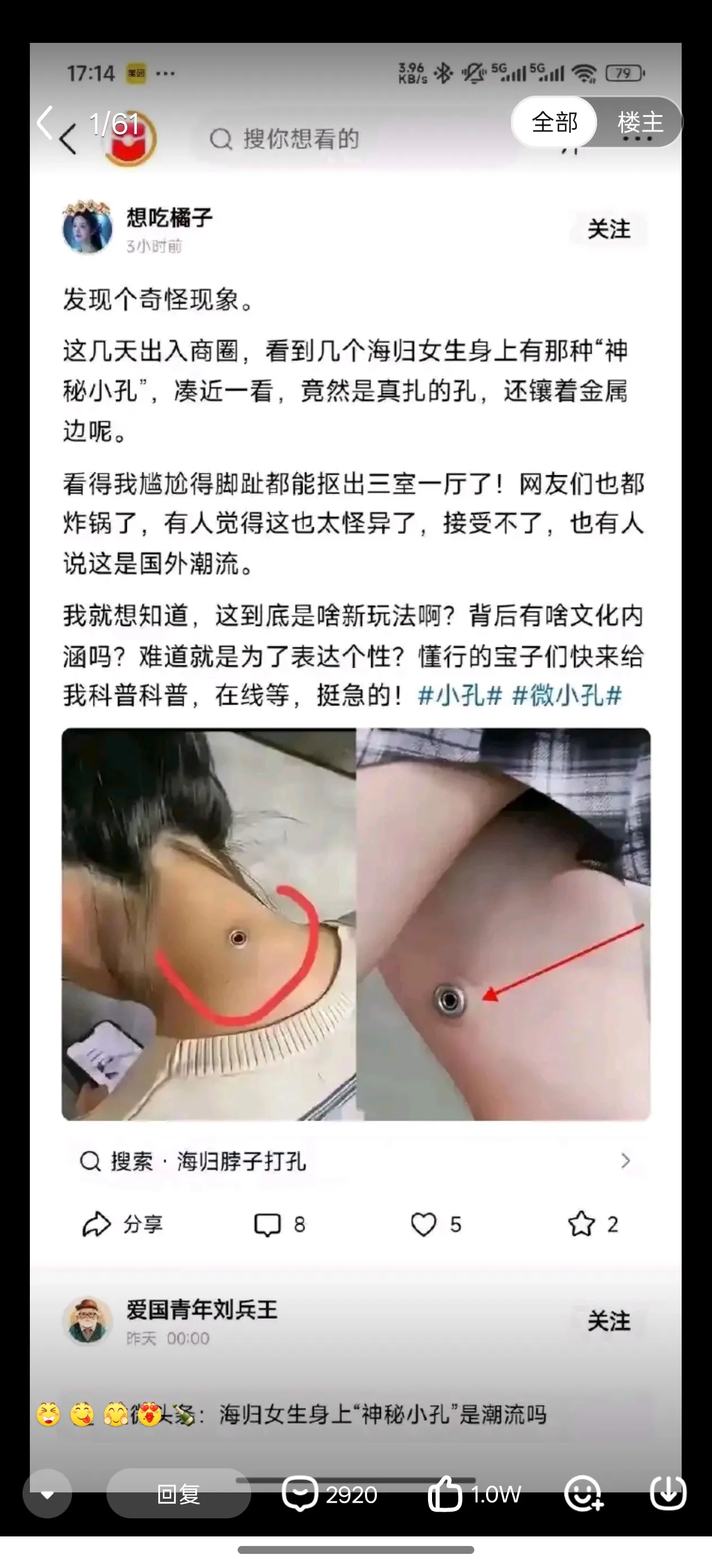 这脖子上的孔是什么 - 生活银魂 - 大众生活 - 万事屋 | 生活·动漫·娱乐综合社区-银魂同好聚集地