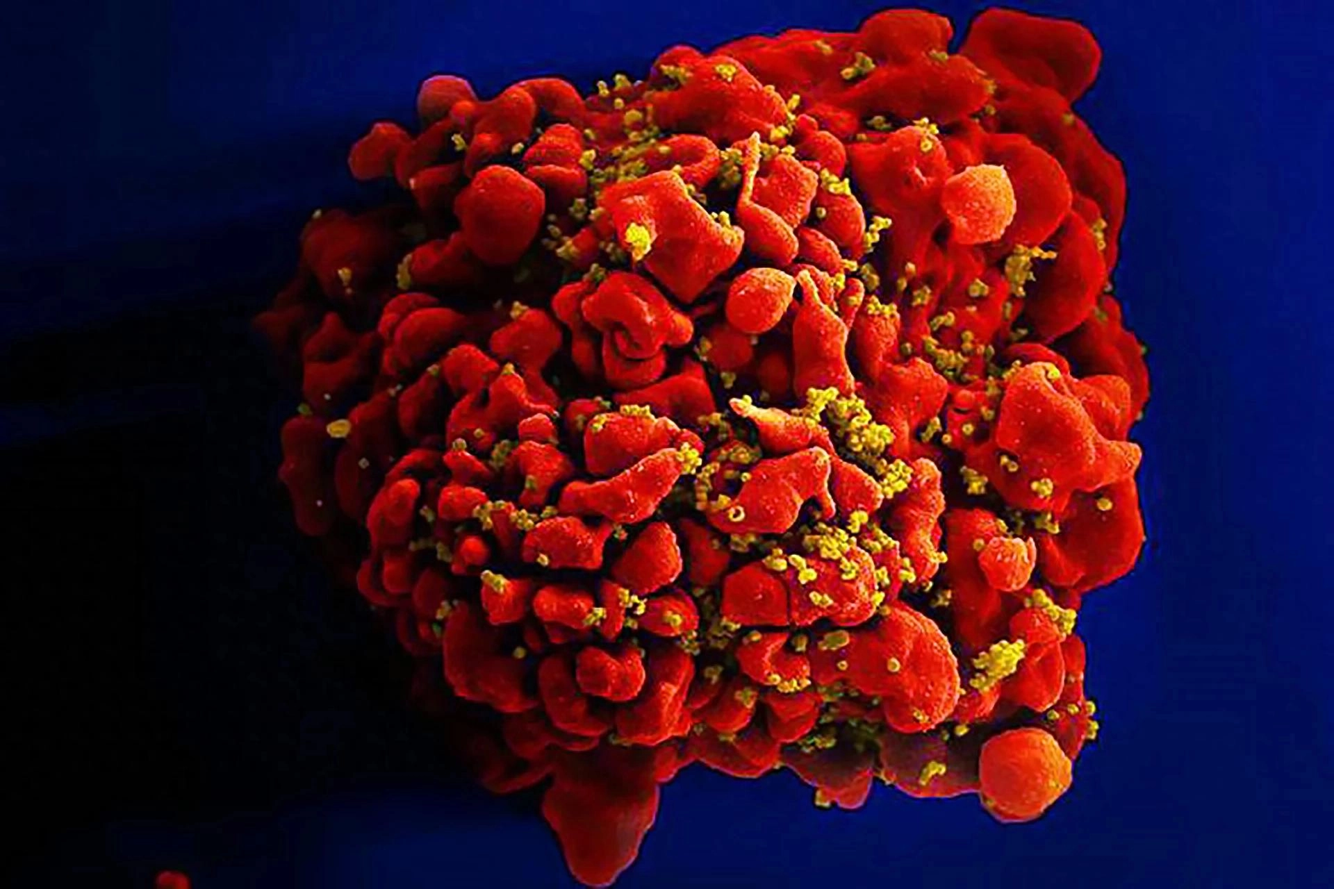 科学家发现HIV整合机制 未来或为艾滋病治疗铺路 - 万事屋 | 生活·动漫·娱乐综合社区-银魂同好聚集地