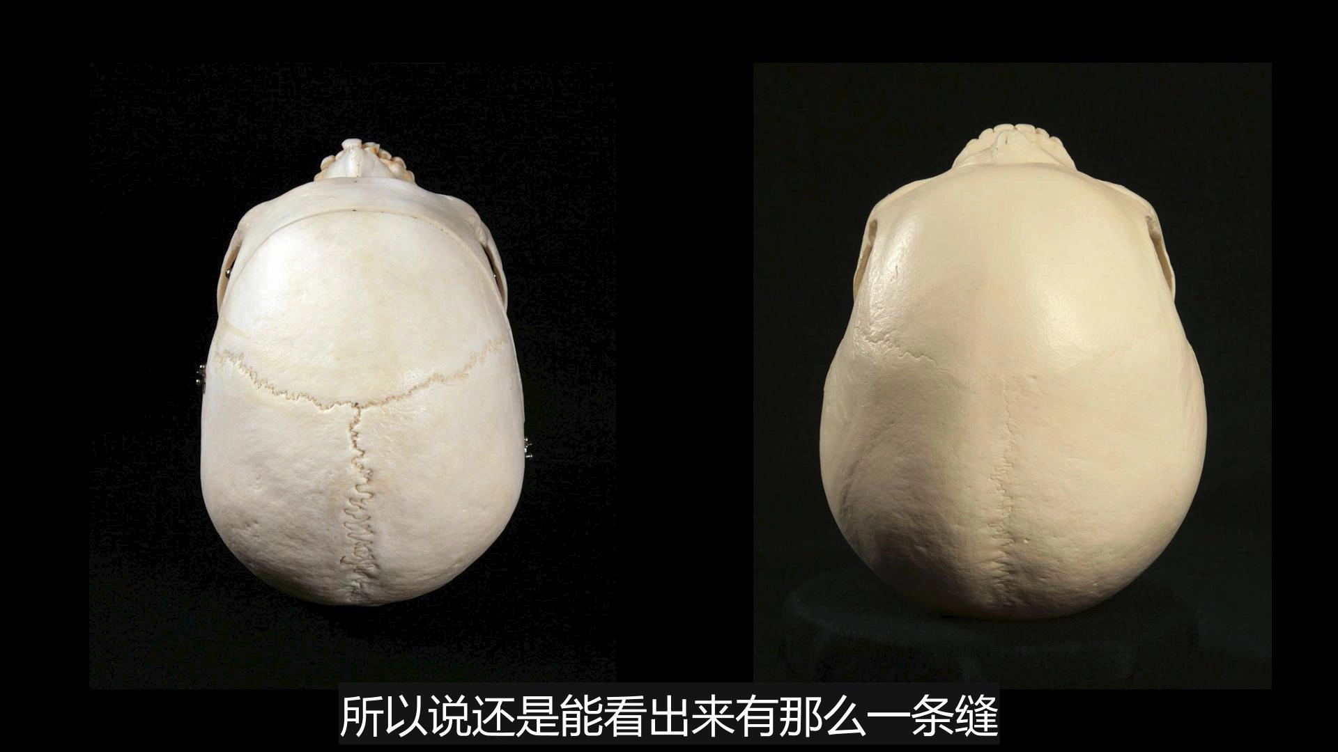 南美惊现“神族遗骸”!DNA检测结果让专家集体沉默