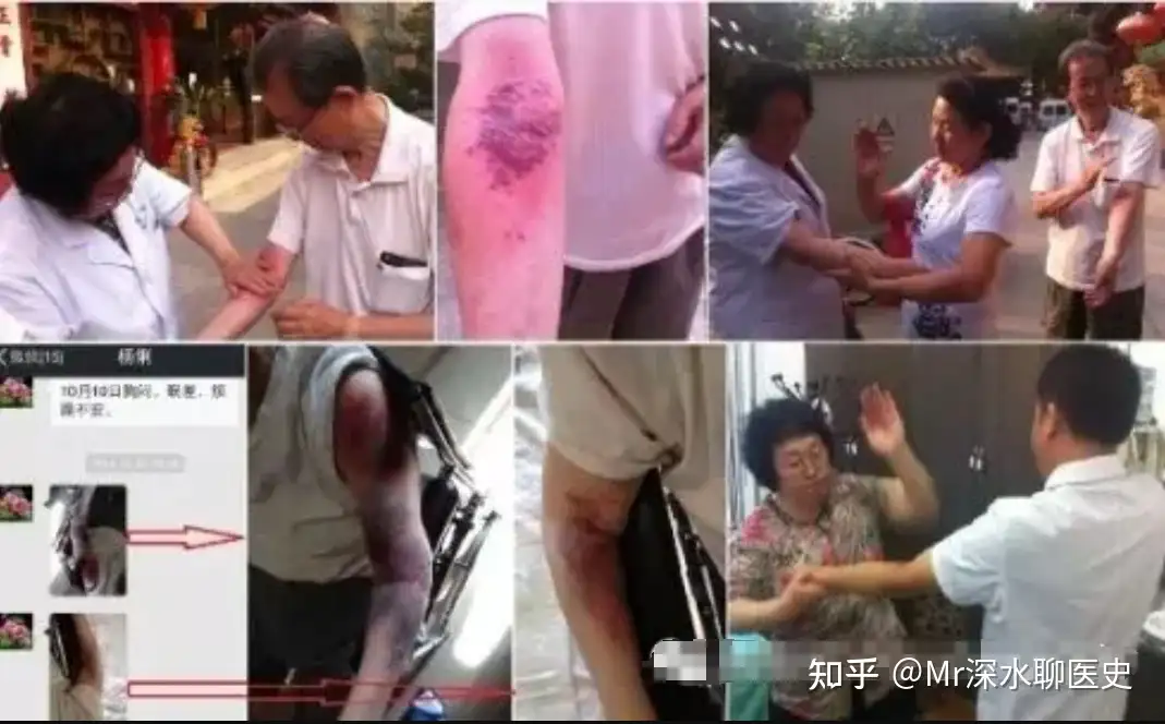 三针救下癫痫病患者是“妙手回春的中医”，还是“有意无意的骗子”？