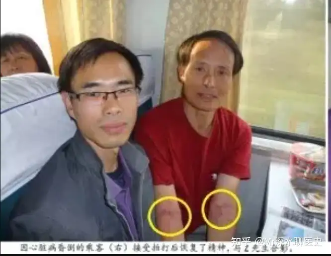 三针救下癫痫病患者是“妙手回春的中医”，还是“有意无意的骗子”？