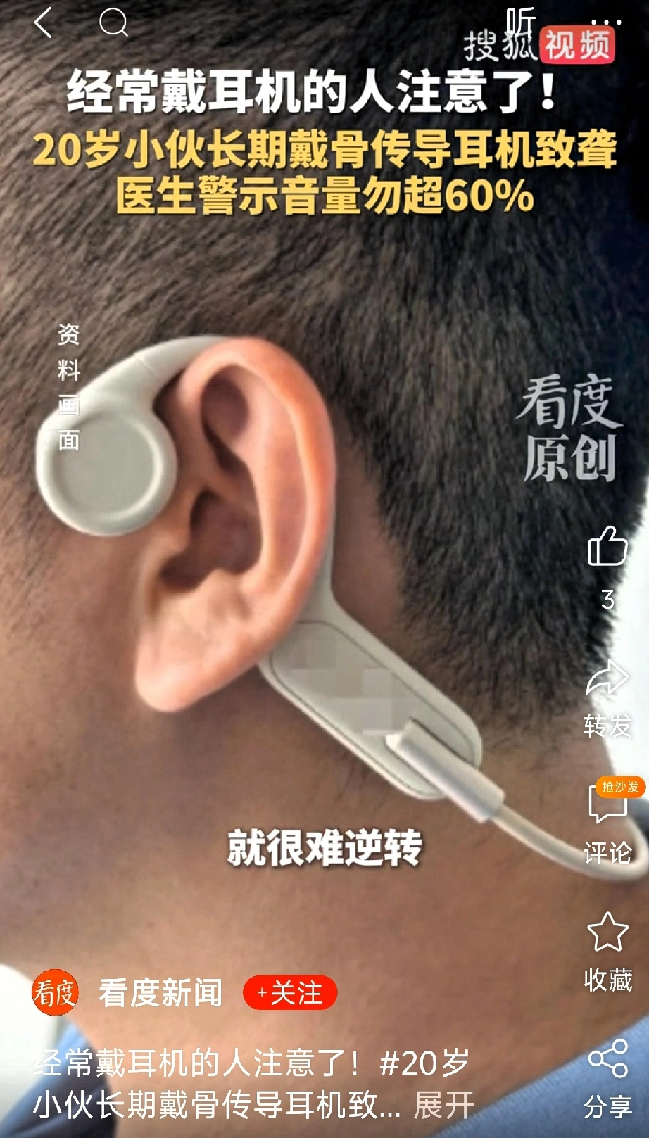 网友分享:我以为骨传导耳机不伤耳朵,才天天戴的 - 万事屋 | 生活·动漫·娱乐综合社区-银魂同好聚集地