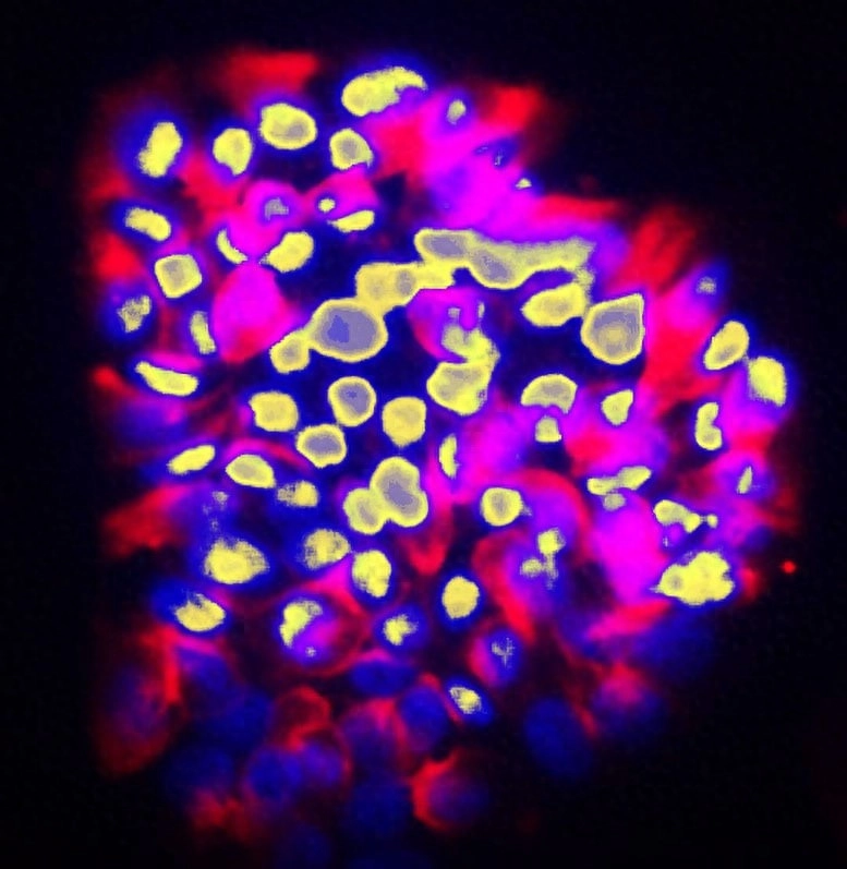 新AI模型高精度预测癌症转移风险 - 万事屋 | 生活·动漫·娱乐综合社区-银魂同好聚集地