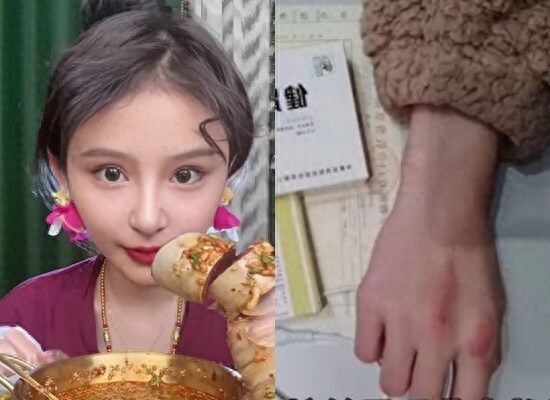 24岁网红吃到死!「一餐吞10kg食物」连吃4hrs 死前曾问:我没了怎办